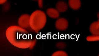Iron Deficiency Symptoms in Mouth | Anaemia Symptoms | Triveni Dental