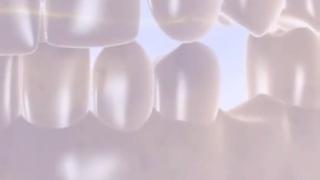 How Dental Implant Crown Is Made | Dental crown | Triveni Dental