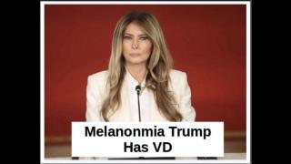 Melanomia Trump - Has VD  -----------  (watch in 720p)