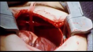Warning disturbing - The Faces of Death 70s Documentary