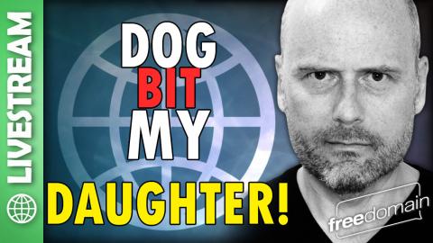 Dog Bit My Daughter! X Space