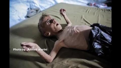 Babies Blown to Pieces and Starved by the JEWS - Backed by the JEW-SA