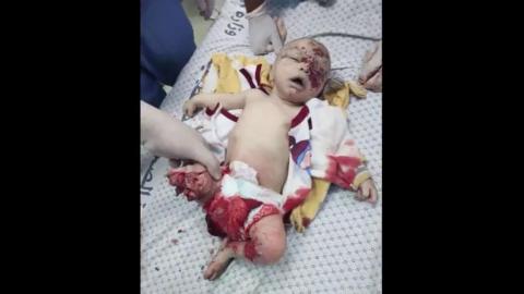 Babies Blown to Pieces and Starved by the JEWS - Backed by the JEW-SA