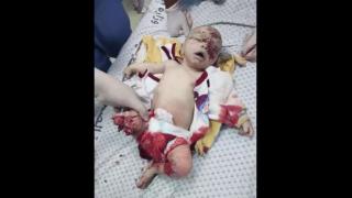 Babies Blown to Pieces and Starved by the JEWS - Backed by the JEW-SA