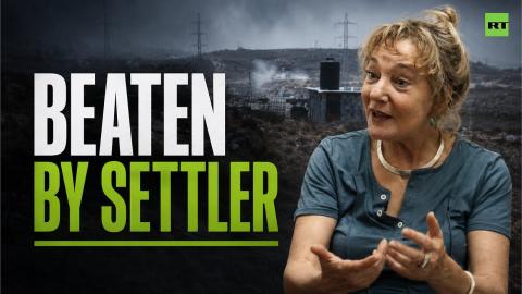 Israeli-Canadian activist beaten by Israeli settler in West Bank