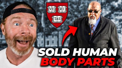 Harvard Sold Human Head, Hands, and Faces on Black Market!