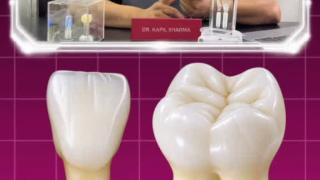 How Much Does Tooth Extraction Really Cost? 5 Factors That Decide It! 🦷💰 | Triveni Dental | Dr. Kapil Sharma