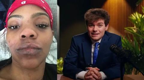 Nick Fuentes calls out Candace Owens for taking $300K to debate Andrew Wilson